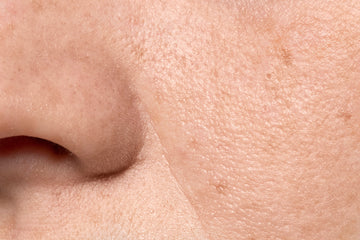 Prickly Pear Seed Oil Benefits for Extremely Dry Facial Skin (Complete Guide)