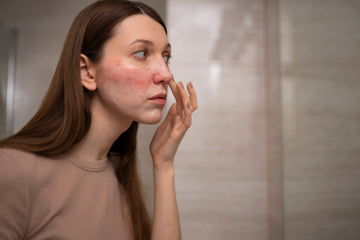 Uneven Skin Tone: Causes and Natural Solutions for a Radiant Complexion in 2025