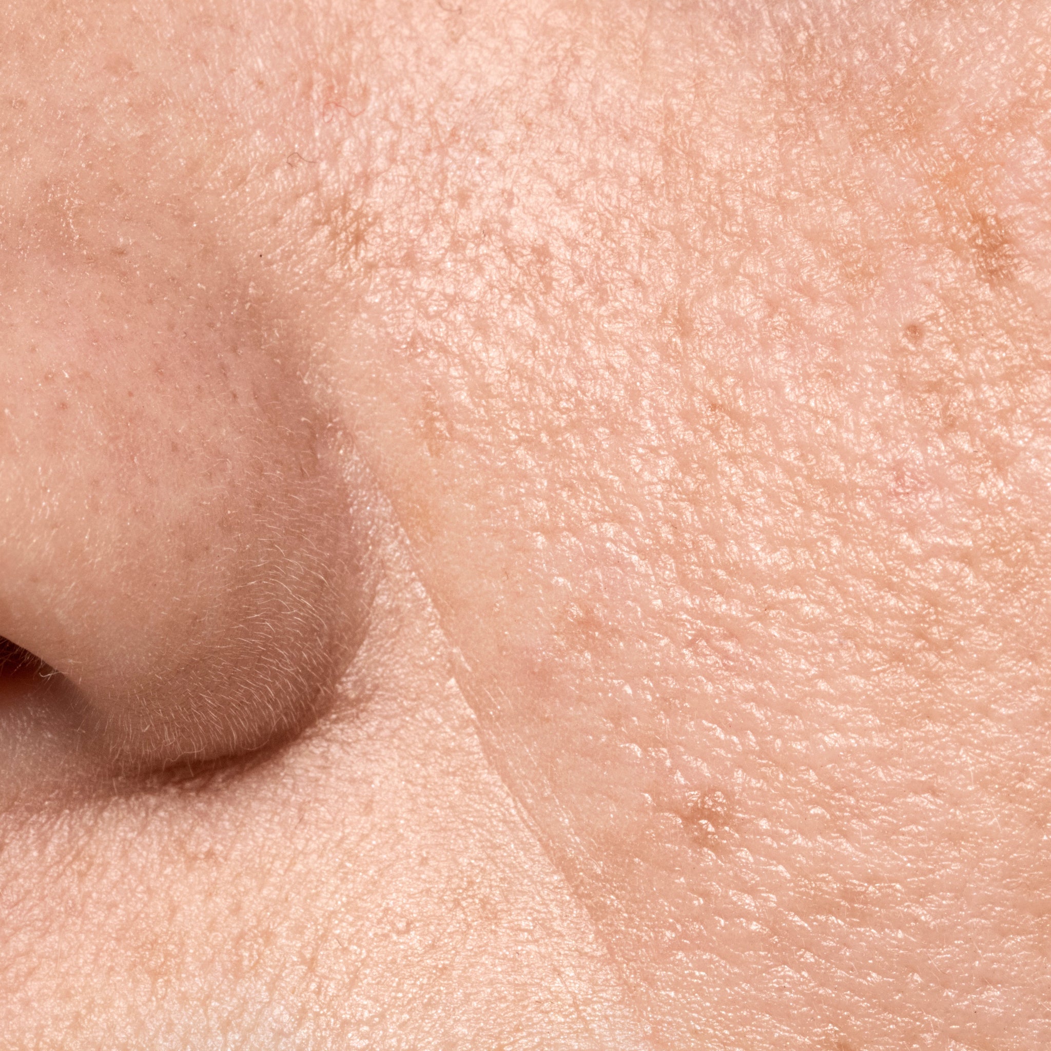 Prickly Pear Seed Oil Benefits for Extremely Dry Facial Skin (Complete Guide)