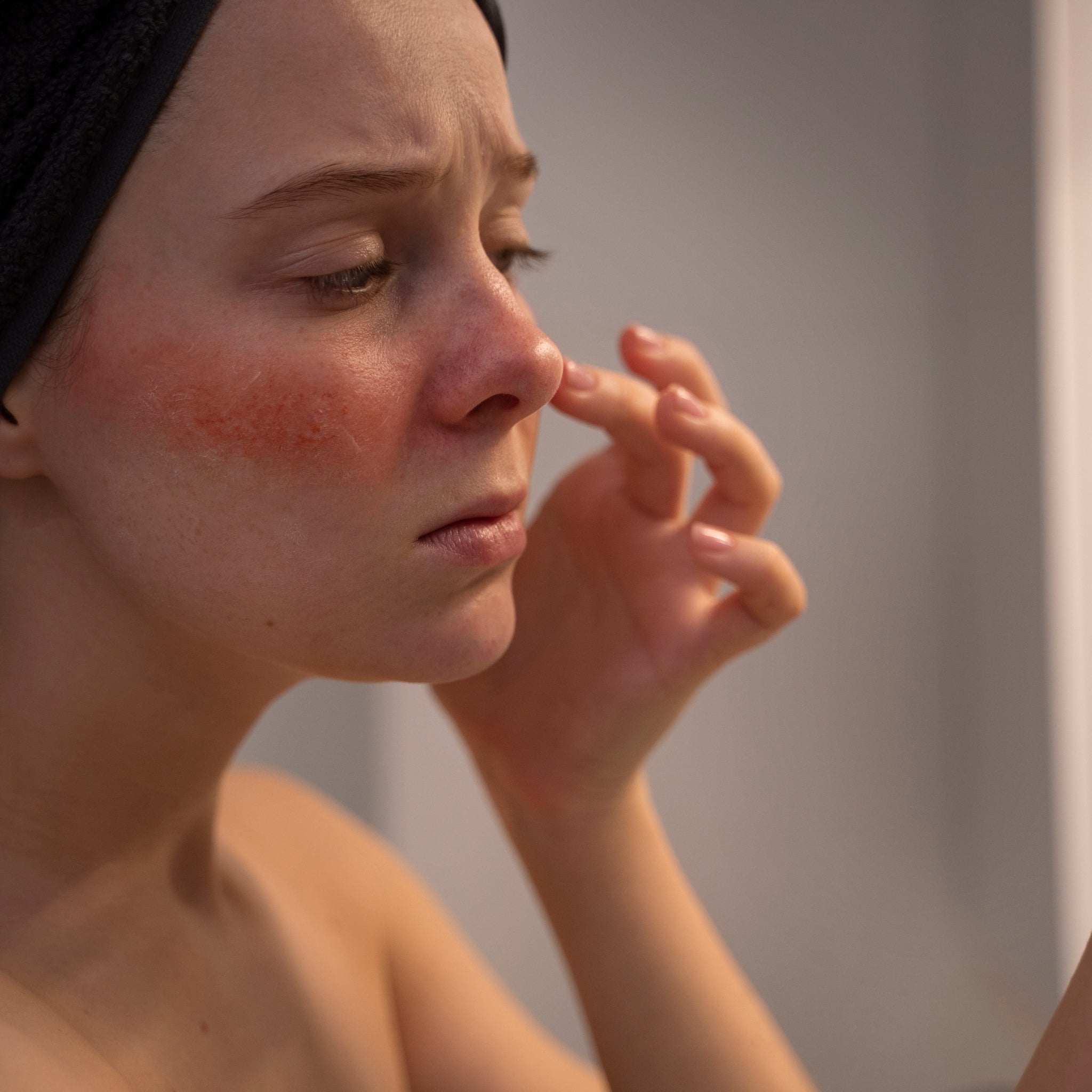 How to Get Rid of Dry Skin Forever: The Complete Natural Guide