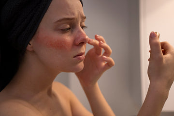 How to Get Rid of Dry Skin Forever: The Complete Natural Guide